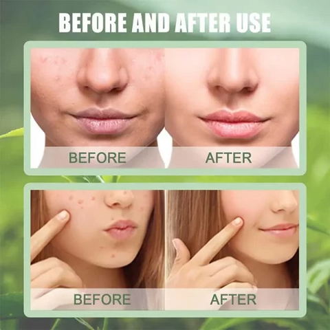 Easy Mart® The Magic Green Stick Mask