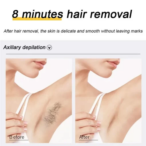 Easy Mart® Ecrin Hair Removal Spray