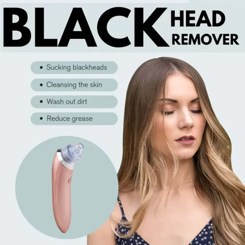 Easy Mart® Blackheads Remover Vacuum